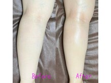 プナヘレ(Punahele)/脚の浮腫みもスッキリ