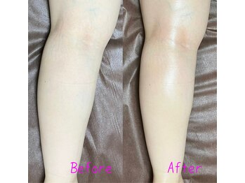 プナヘレ(Punahele)/脚の浮腫みもスッキリ