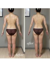 エヌボーテ(N. beaute)/before→after7回目