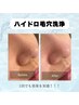 人気No.1【SNSで話題◆毛穴詰まり黒ずみ除去】ハイドロ毛穴洗浄 ¥7000→¥5600