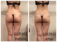 ミ ライト(m light)/