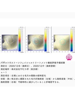オフモード(OffMode)/これがエビデンスの力！！