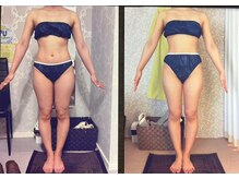 パーフェクトボディプレミアム 大阪梅田店(PERFECT BODY PREMIUM)/お客様　ビフォーアフター（6）