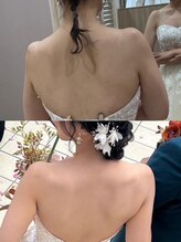 ニコ(nico)/nico/ブライダルエステ