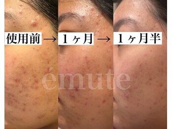 アンビワン(Anbione.)/クレンジングはスキンケア★