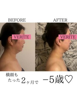 ワン ストレッチ(ONE stretch)/【たった2ヶ月の変化!】