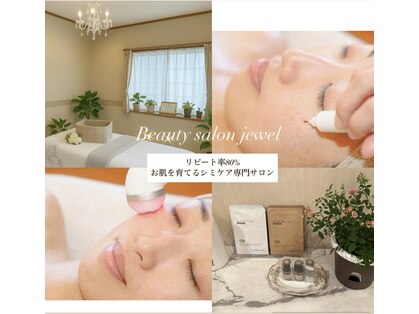 ジュエル(jewel)の写真