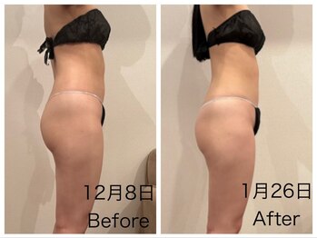 ミ ライト(m light)/