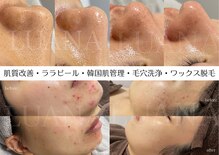 ルアナ(LUANA)