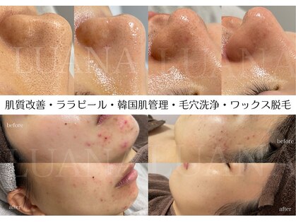 ルアナ(LUANA)の写真