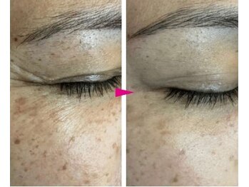 プリオール 高崎花水木店(Prior)/ヒト幹細胞×エステダーマ