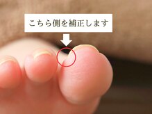 ルポ 伊勢/ご来店～施術終了までの流れ　3