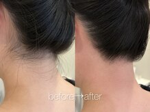 リコ ヘアアンドリラクゼーション(LICO)/うなじワックス