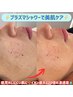 【肌荒れSOS】プラズマシャワー集中ケア 5000円