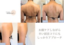 ステラ(STELLA)