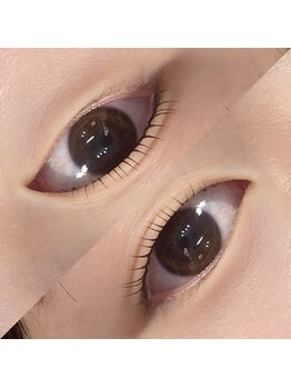 マーブル(marble)/ラッシュリフト