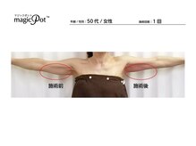 ルルン(LuLuN)/二の腕、デコルテ、背中、首