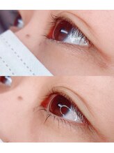 イチマルニ(102)/ラッシュリフト下まつげのみ♪