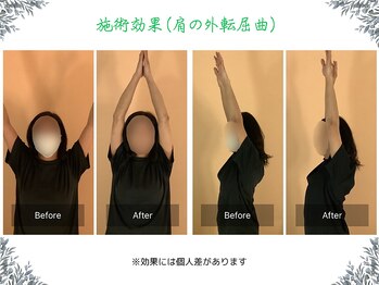 ボディ リセット アンド デザイン(Body Reset & Design)/【施術例】ビフォーアフター