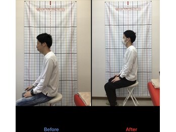 きずな鍼灸整骨院 光の森院/姿勢の悪さからくる頭痛や肩こり