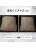 ぽっこりお腹解消!美bodyくびれ◇Wキャビ3spro&筋膜リリース吸引&深層リンパ