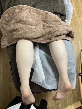 ビューティーエー(Beauty I)/痩身