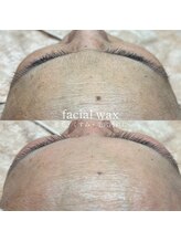 コア(koa)/フェイシャルワックス/東大阪