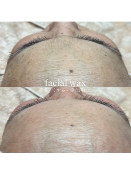コア(koa)/フェイシャルワックス/東大阪