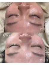 ユンプラス(yun+)/【Before/After】