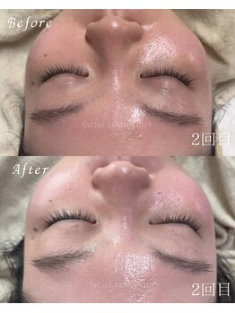 ユンプラス(yun+)/【Before/After】