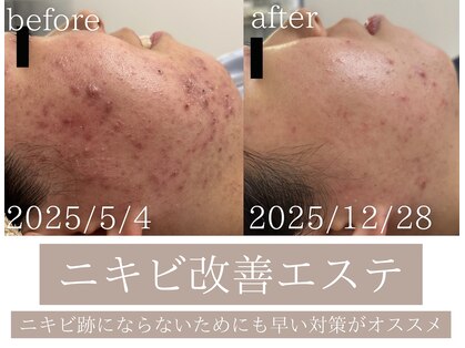 サロン イナンナ(Salon INANNA)の写真