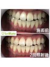 ルブラン 奈良店(Le Blanc)/くすみが取れ艶が出る！