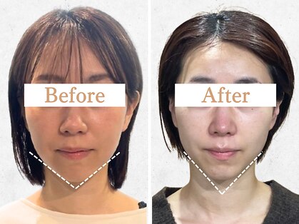 フローフシ∞の写真