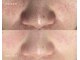 ルポ 鶴見(Repos)の写真/【黒ずみ毛穴・角栓・皮脂撃退】汚れを洗い流し、毛穴引き締め★小鼻の乾燥も同時解消★