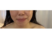 ハイカラマッサージ/フェイシャル60分コース
