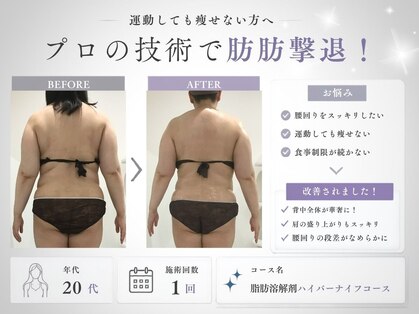 ミヨンラボ(miyon LABO)の写真