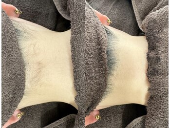 サロン ヴィラ(villa)/#脱毛#光脱毛#都度払い#うなじ