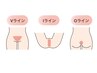 クリアスキン美肌脱毛【ご新規様・男女】vio脱毛(デリケートゾーン)4,400円