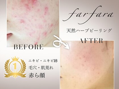 ファルファラ(farfara)の写真