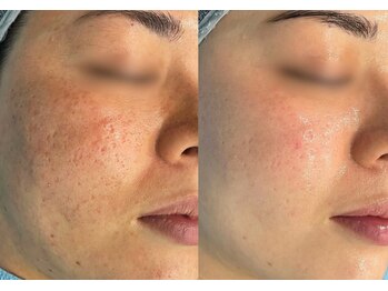 リメイククリニカルビューティー(Remake clinical beauty)/