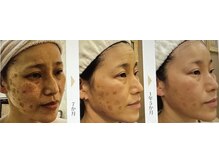 セラビシャン/before→after