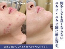 エピア 豊橋店(Epia)