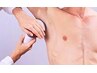 お試し【メンズ】痛みが弱い方にも◎高速全身脱毛（顔・VIO除く）13000→9500