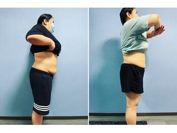 ストルツ(STOLZ)/約2.5ヶ月でこの変化!