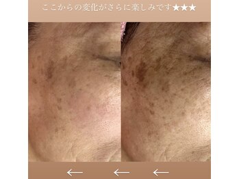 フェミニー(Feminy)/Instagramをチェック♪