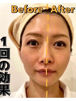 スペチアーレ 夙川/いま話題の人気メニュー！