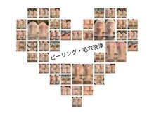 ケアナ 梅田店(CareNa)/ピーリング・毛穴洗浄【梅田】