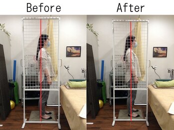 ライズ整体院/【猫背・スマホ首・骨盤矯正】