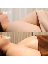 アンドボディ 横浜元町(&Body)/30代後半 バストアップ