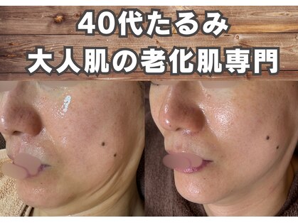 フェイス(FACE)の写真